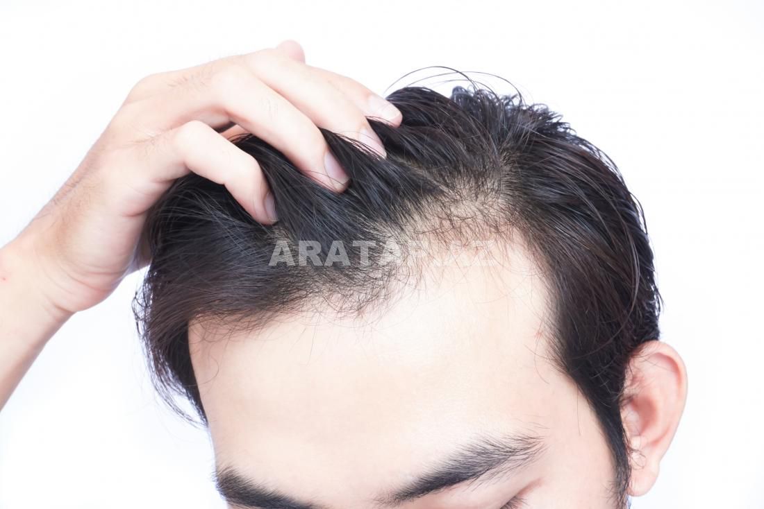Zobla bağlı saç tökülməsinin müalicəsi