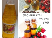 Soyuq Sıxım İtburnu Yağı